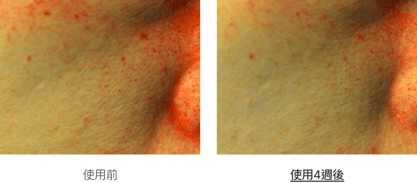 실험 대상자들의 피부 표면 수분량 변화