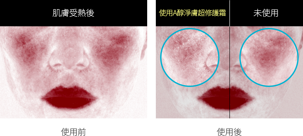 가온 후 레티놀 시카 크림 사용 후